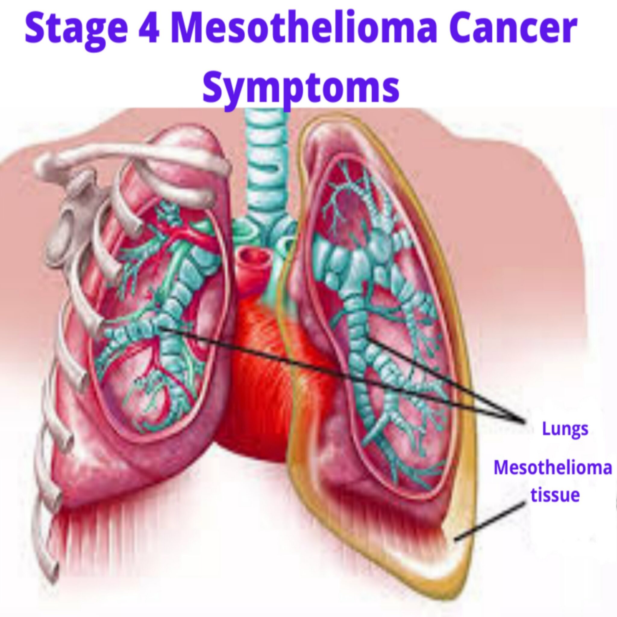 what-happens-in-the-final-stages-of-mesothelioma-bright-cures