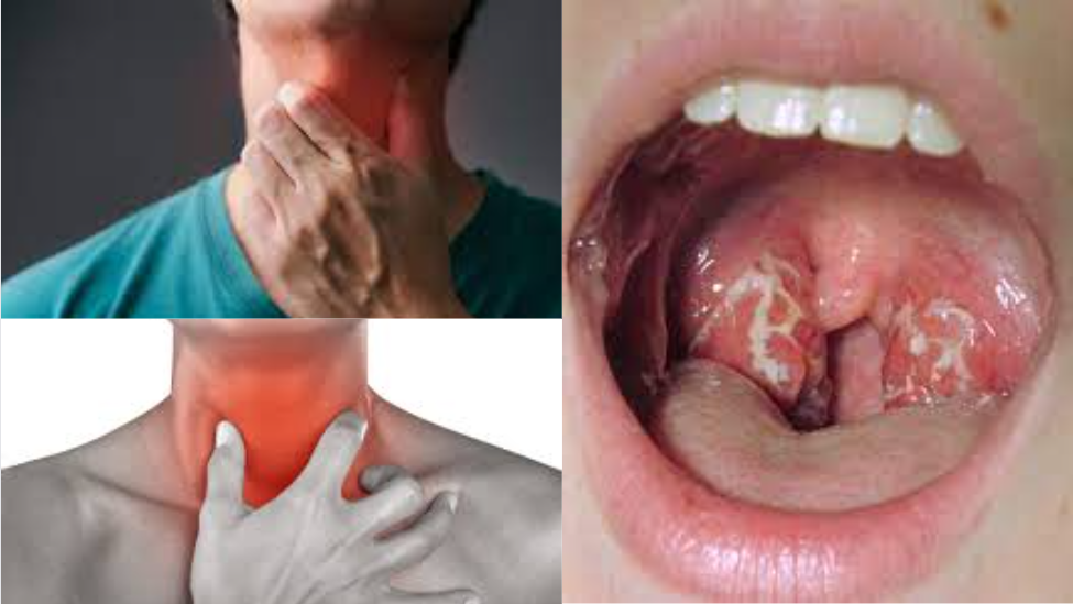 How To Cure A Sore Throat Fast How To Fix A Sore Throat Bright Cures