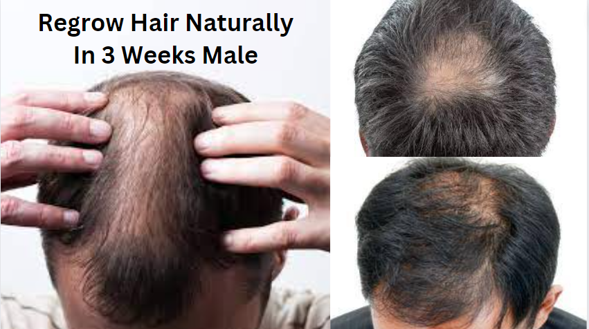 Regrow Hair Naturally In 3 Weeks Male Bright Cures 1691