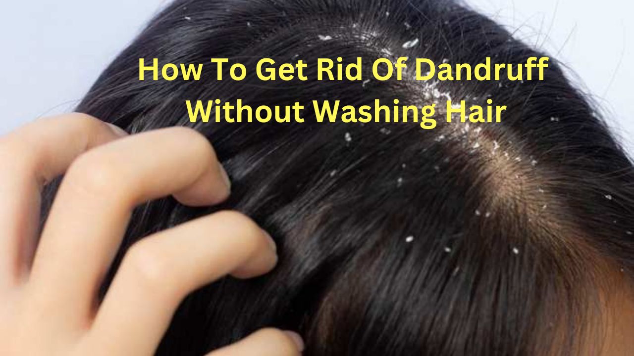 How To Get Rid Of Dandruff Without Washing Hair - Bright Cures